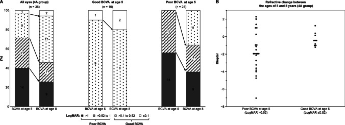 Long-term visual function and refractive changes after vitrectomy for stage 4 retinopathy of prematurity.