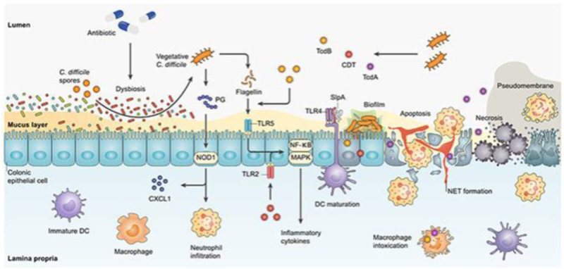 Fecal microbiota transplantation as a therapeutic modality for recurrent <i>Clostridioides difficile</i> infection: reviewing efficacy, safety, mechanisms of action, and outcomes.
