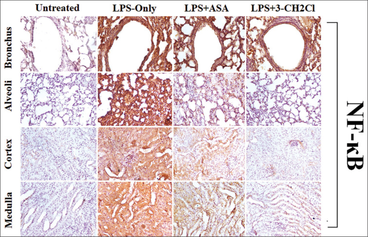2-((3-(chloromethyl) benzoyl) oxy) benzoic acid suppresses NF-κB expression in the kidneys and lungs of LPS-Induced BALB/C mice.
