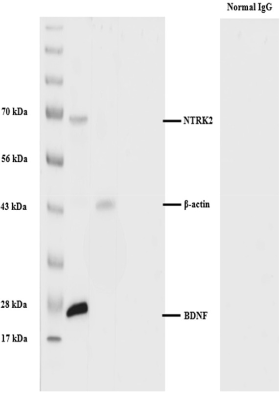 Brain-derived neurotrophic factor and neurotrophic tyrosine receptor kinase-2 in stallion testes: insights into seasonal changes and potential roles in spermatogenesis.