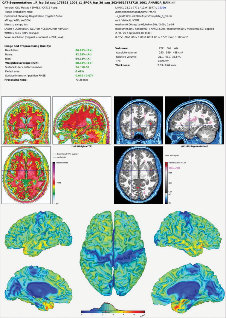 Differential effects of obesity and hypertension on brain structure and cognitive ability: A subgroup analysis from nested study.