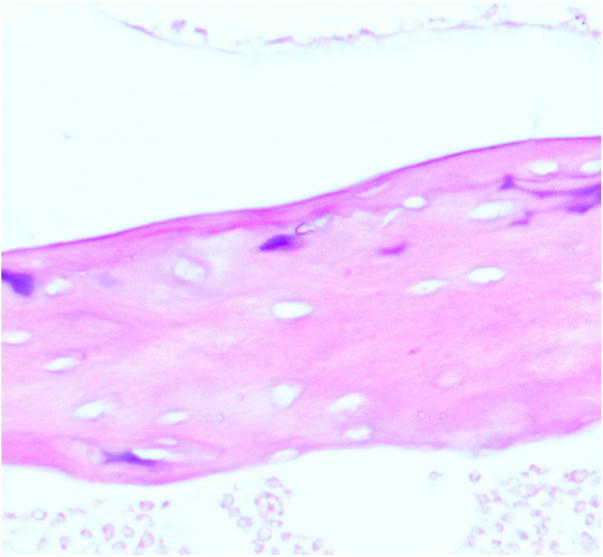 The mechanism of NK cell expression of RANKL/RANK/OPG pathway in mouse models of femoral head necrosis.
