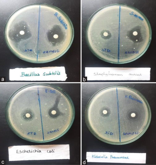 Potent antiurolithiasis activity of Phaseolus vulgaris aqueous extract and its nano-formulation on ethylene glycol-induced urolithiasis in rats.