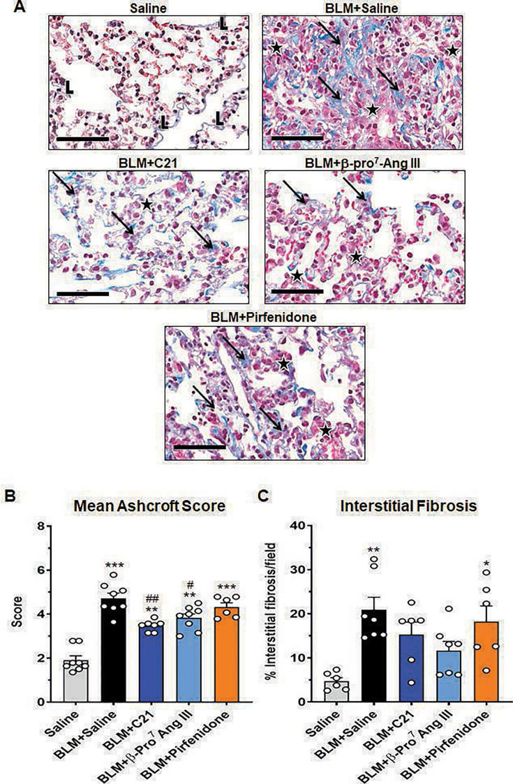 The novel AT2 receptor ligand, β-Pro7 Ang III, induces equivalent anti-fibrotic effects to Compound 21 but broader anti-fibrotic effects than pirfenidone in mice with bleomycin-induced pulmonary fibrosis.