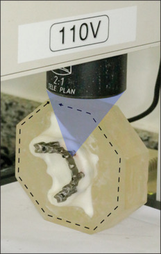 Marginal gap of three-dimensional printed full-arch frameworks supported by all-on-four and all-on-six implant designs.