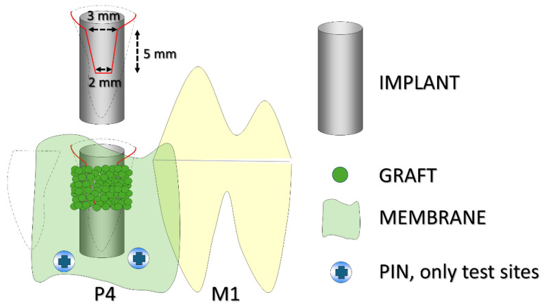 The Effect of Collagen Membrane Fixation with Pins on Buccal Bone Regeneration in Immediate Dental Implant Sites: A Preclinical Study in Dogs.