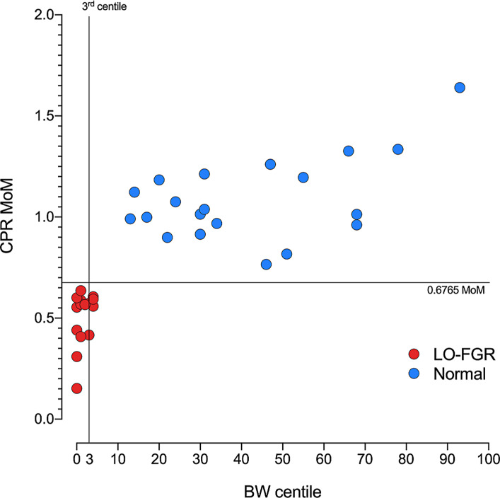 Differential Expression of Micro-RNA in Maternal Blood of Pregnancies Affected with Late-Onset Fetal Growth Restriction.