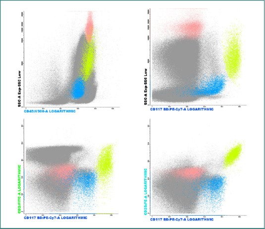 Real-world characteristics of systemic mastocytosis in Romania: insights from a reference-center-based descriptive study.