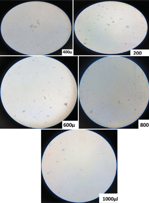 Potent antiurolithiasis activity of Phaseolus vulgaris aqueous extract and its nano-formulation on ethylene glycol-induced urolithiasis in rats.