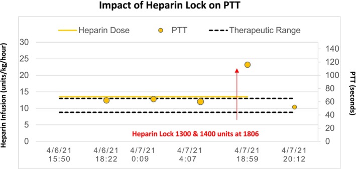 Impact of Heparin Hemodialysis Catheter Lock on Partial Thromboplastin Time Assays in Inpatients on Therapeutic Intravenous Heparin.