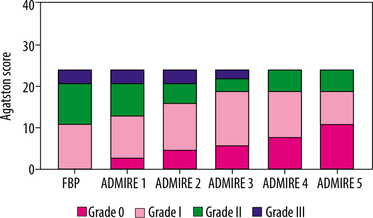 Impact of the ADMIRE reconstruction algorithm combined with the Sa36 kernel on quantitative measurement of coronary artery calcification in AI: a single-arm prospective study.