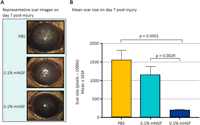 Topical Hepatocyte Growth Factor Accelerates Wound Healing and Inhibits Scarring in Experimental Corneal Injury.