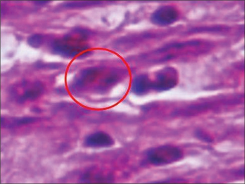 Spray film-forming system formulation of <i>Mitragyna speciosa</i> as a diabetic wound healer.