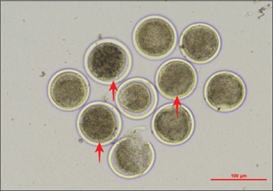 Post-warming quality of goat oocytes under heat shock stress: A study of the maturation rate, heat shock protein-70, adenosine triphosphate, and glutathione levels.