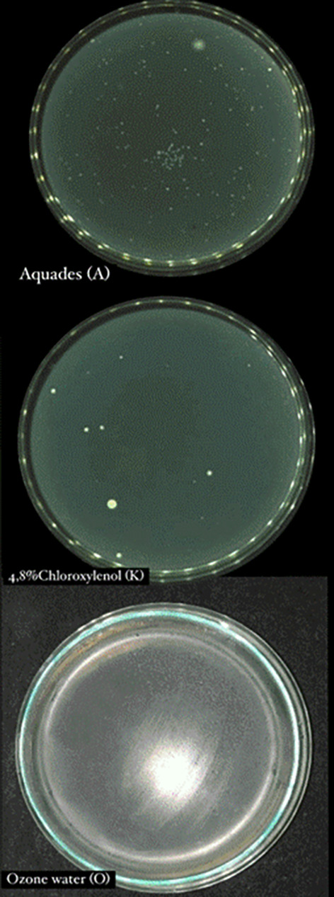 Ozone water or chloroxylenol: The comparison of disinfection effectiveness against the number of bacterial colonies in dental extraction instruments at the Universitas Sumatera Utara Dental and Oral Hospital.
