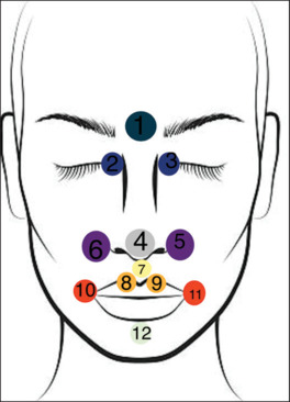 Comparative evaluation of the accuracy of three different three-dimensional facial scanning systems: An observational crossover study.