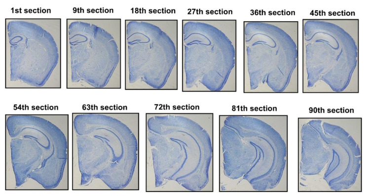 Quercetin mitigates aluminum nanoparticle-induced neurotoxicity: a stereological and molecular study on memory, hippocampal integrity, and MAPK signaling.