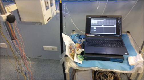 Study of Motor Evoked Potential on Intraoperative Neurophysiological Monitoring Cases of Neurosurgeries.