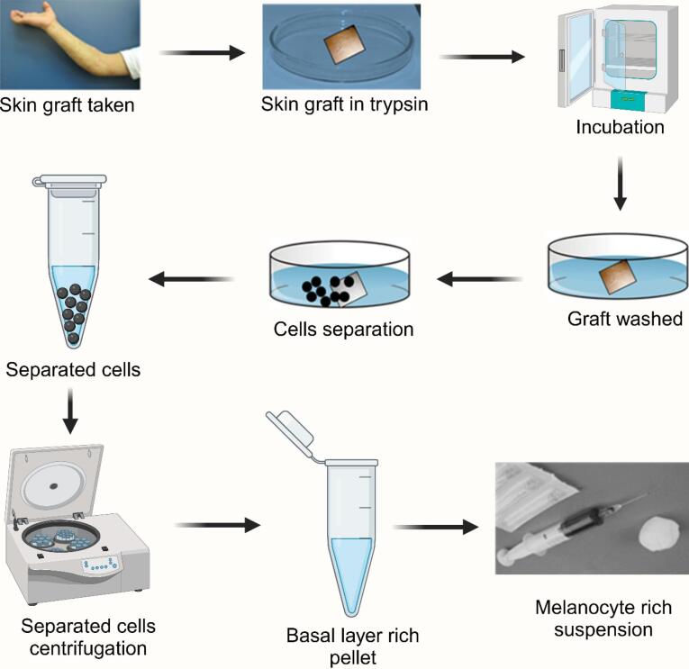 Lipid-based nanoparticles: advancing therapeutic strategies for vitiligo management.