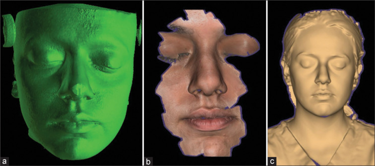 Comparative evaluation of the accuracy of three different three-dimensional facial scanning systems: An observational crossover study.