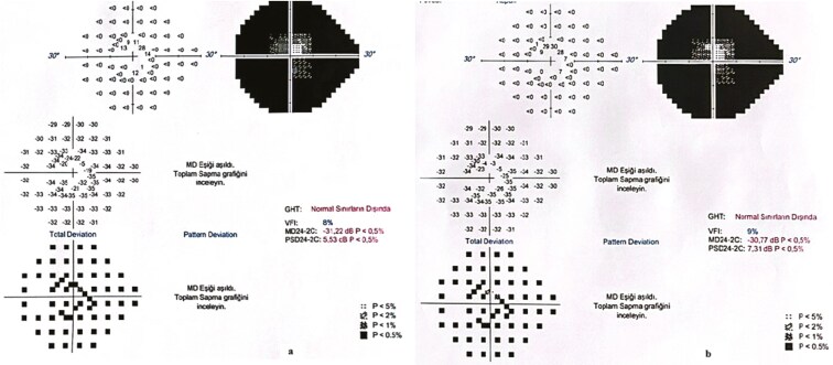 Evaluating the long-term efficacy of umbilical cord-derived mesenchymal stem cell therapy in retinitis pigmentosa: findings from a 1-to-4-year follow-up.