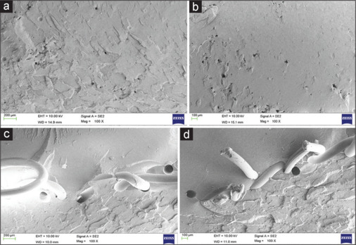Effect of simulated gastric acid on the mechanical properties of conventional and polypropylene mesh reinforced poly methyl methacrylate denture base resin.