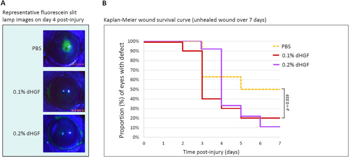 Topical Hepatocyte Growth Factor Accelerates Wound Healing and Inhibits Scarring in Experimental Corneal Injury.