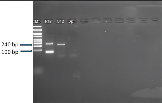 Prevalence of <i>Plasmodium</i> spp. in humans and cattle: Implications for zoonotic malaria transmission in Indonesia.
