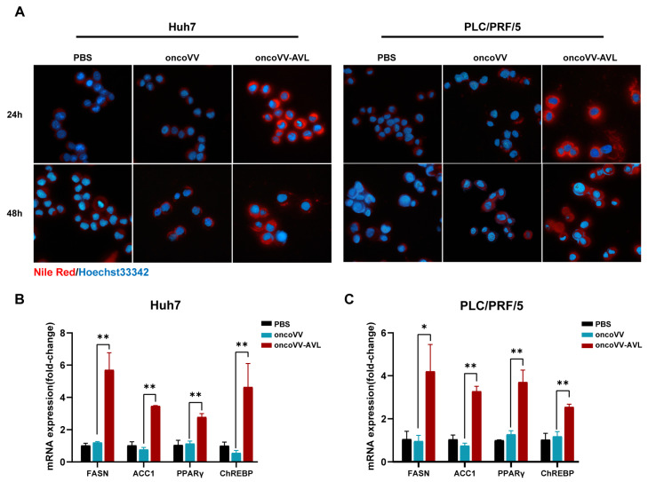 An Oncolytic Vaccinia Virus Expressing Aphrocallistes Vastus Lectin Modulates Hepatocellular Carcinoma Metabolism via ACSS2/TFEB-Mediated Autophagy and Lipid Accumulation.