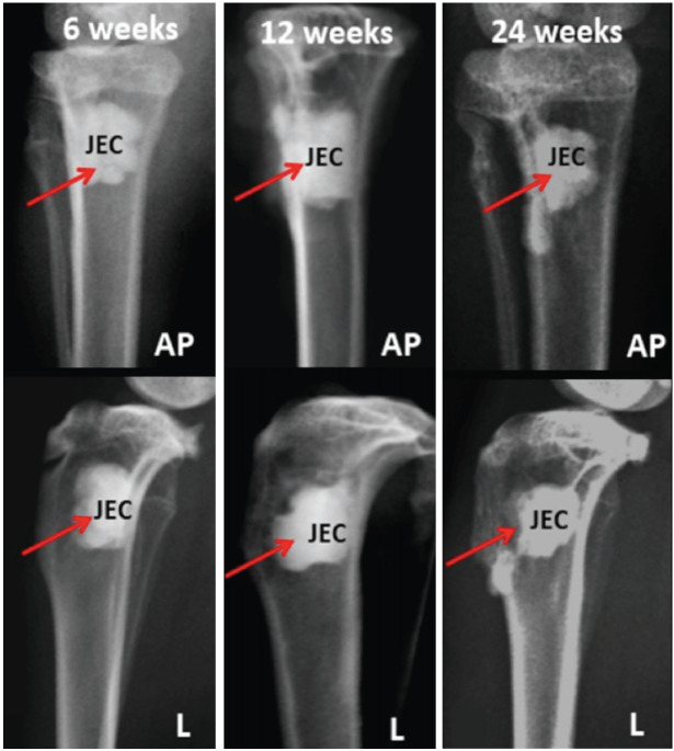 Radiographical Assessment of Injectable Calcium Phosphate Bone Cement (Osteopaste) in Critical Size Bone Defects of Rabbit's Tibia Model.