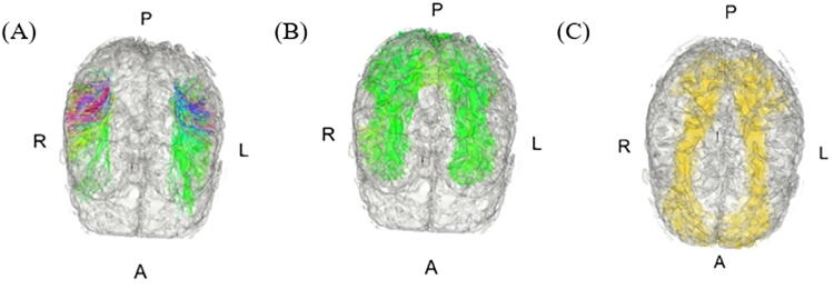Longitudinal Multimodal Magnetic Resonance Imaging Reveals Improvement in Verbal Fluency Over Time in Moderate-to-Severe Traumatic Brain Injury.