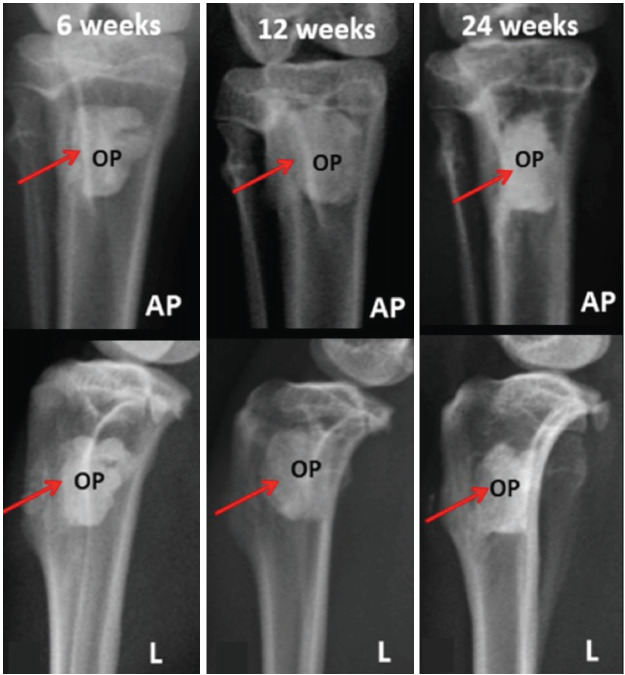 Radiographical Assessment of Injectable Calcium Phosphate Bone Cement (Osteopaste) in Critical Size Bone Defects of Rabbit's Tibia Model.