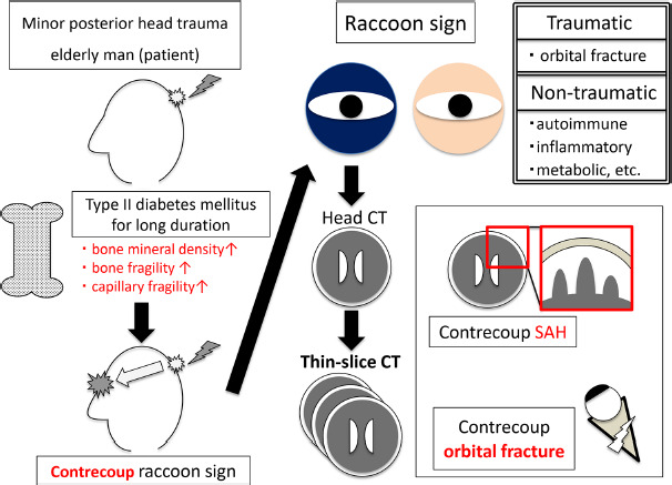 Contrecoup raccoon sign following minor posterior head injury without visible injury: Diagnostic challenge in an asymptomatic older adult man.