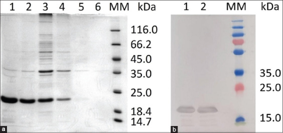 Development and validation of a recombinant Rap1-based lateral flow immunoassay for rapid serodiagnosis of bovine babesiosis in Kazakhstan.