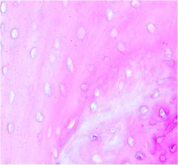 The mechanism of NK cell expression of RANKL/RANK/OPG pathway in mouse models of femoral head necrosis.