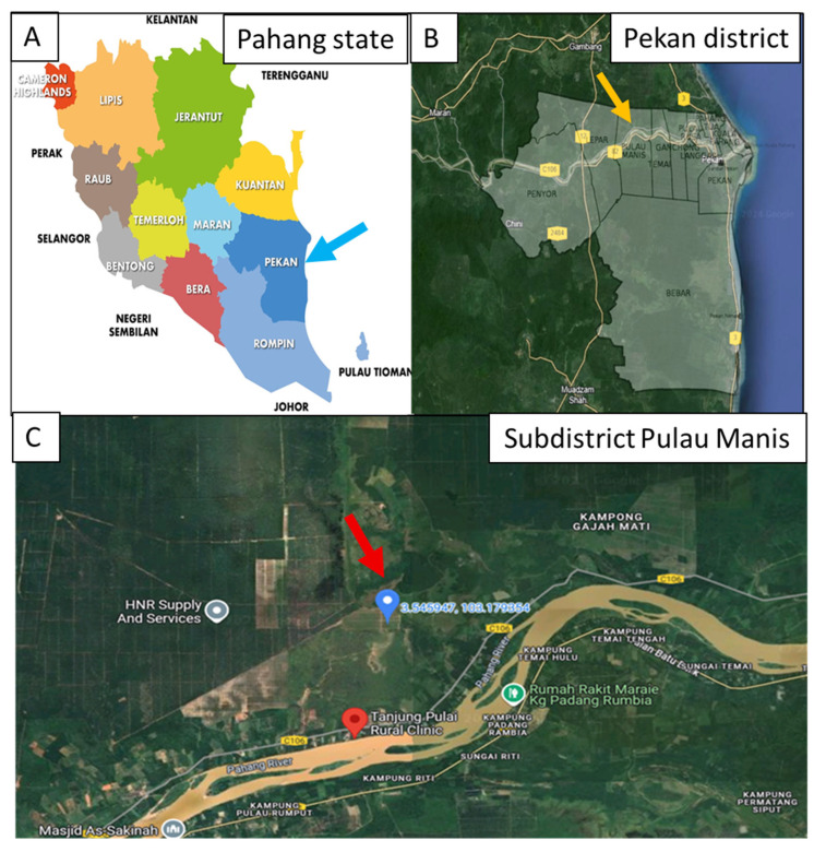 Severe Scrub Typhus with Acute Kidney Injury: Urine PCR Evidence from an East Coast Malaysian Cluster.