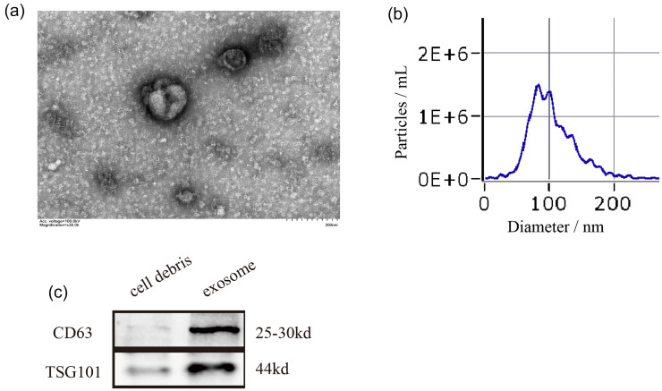 Role of thrombus-derived exosomal lncRNA LOC101928697 in regulating endothelial function via FUS protein interaction in myocardial infarction.