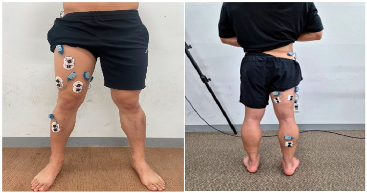 Comparison of Lower Limb COP and Muscle Activation During Single-Leg Deadlift Using Elastic and Inelastic Barbells.
