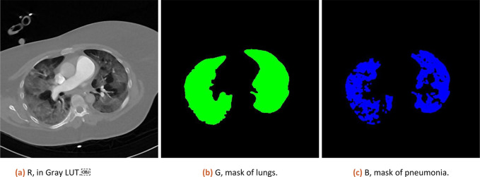 Estimation of Covid-19 lungs damage based on computer tomography images analysis.