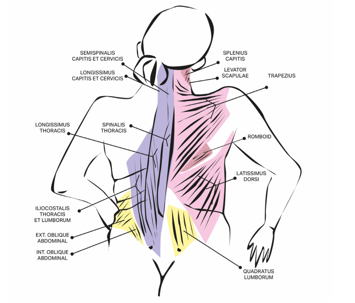Case Series and Literature Review on Botulinum Toxin Efficacy in Axial Extensor Truncal Dystonia.