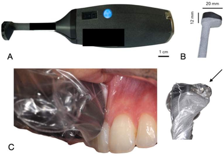 Ultrasound Imaging: Advancing the Diagnosis of Periodontal Disease.