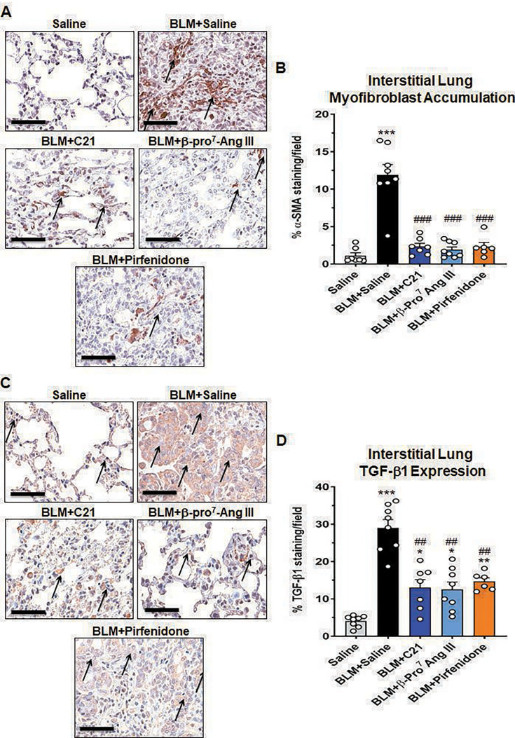 The novel AT2 receptor ligand, β-Pro7 Ang III, induces equivalent anti-fibrotic effects to Compound 21 but broader anti-fibrotic effects than pirfenidone in mice with bleomycin-induced pulmonary fibrosis.