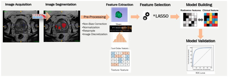 The Role of Radiomic Analysis and Different Machine Learning Models in Prostate Cancer Diagnosis.