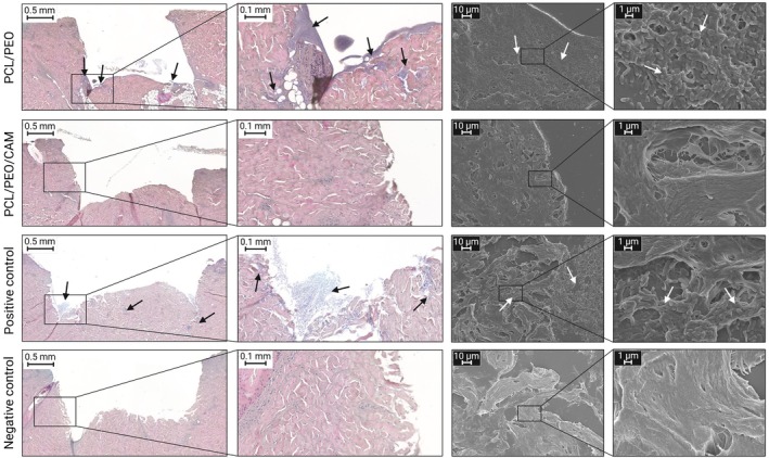 Development of Rapid and Economic In Vitro Assay and Biorelevant Ex Vivo Biofilm Inhibition Wound Model to Test the Antibacterial Efficacy of Wound Dressings.