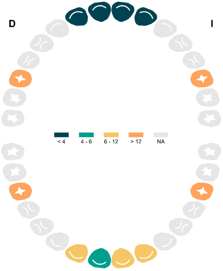 MIH and Cavities as Markers of Oral Health Inequality in Children from Southwest Andalusia (Spain).