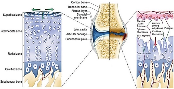 Engineered Extracellular Vesicles in Arthritic Diseases: Therapeutic Applications & Challenges.
