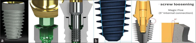 Comparison of bacterial colonization of implant abutment internal recess in internal hex and conical connection implants: An in vivo prospective study.