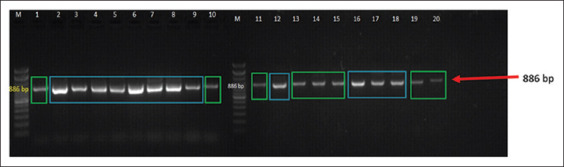 Reproductive performance and fertility traits in Madrasin cattle: The influence of <i>growth differentiation factor-9</i> gene expression on reproductive tract size, cervical mucus characteristics, and fertility rate.