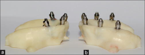 Marginal gap of three-dimensional printed full-arch frameworks supported by all-on-four and all-on-six implant designs.