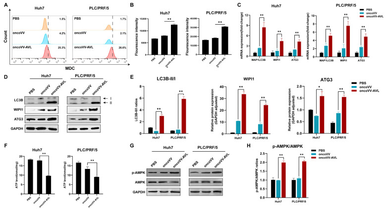 An Oncolytic Vaccinia Virus Expressing Aphrocallistes Vastus Lectin Modulates Hepatocellular Carcinoma Metabolism via ACSS2/TFEB-Mediated Autophagy and Lipid Accumulation.